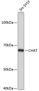 Anti-CHAT Antibody (CAB19031)