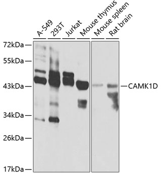 Anti-CAMK1D Antibody (CAB7512)