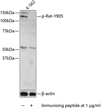 Anti-Phospho-Ret-Y905 Antibody (CABP0600)