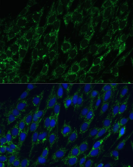 Anti-IDH2 Antibody (CAB7190)