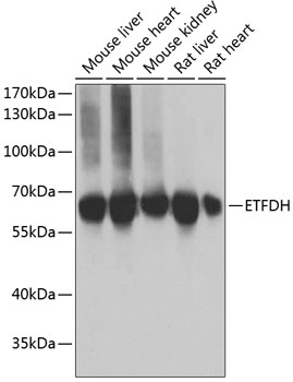 Anti-ETFDH Antibody (CAB6585)