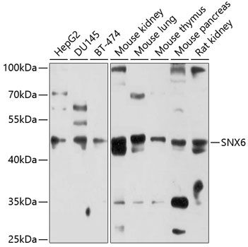 Anti-SNX6 Antibody (CAB10039)