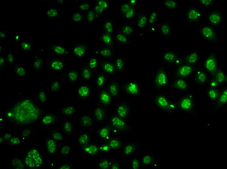 Anti-LDLRAP1 Antibody (CAB7093)