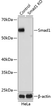 Anti-Smad1 Antibody [KO Validated] (CAB19113)