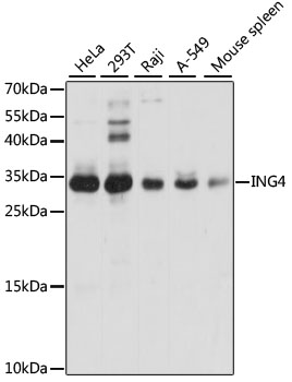 Anti-ING4 Antibody (CAB5833)