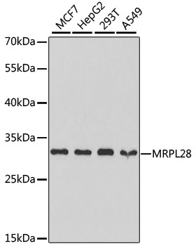 Anti-MRPL28 Antibody (CAB5897)
