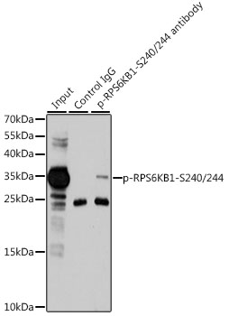 Anti-Phospho-RPS6-S240/244 Antibody (CABP0537)