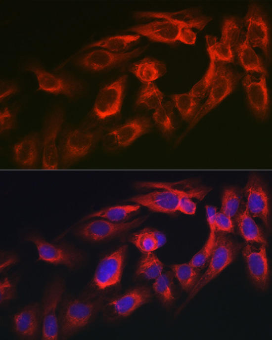 Anti-MYO10 Antibody (CAB12471)