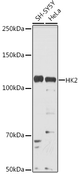 Anti-HK2 Antibody [KO Validated] (CAB0994)