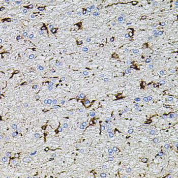 Anti-TRPA1 Polyclonal Antibody (CAB8568)