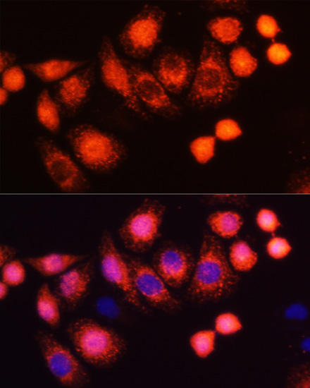 Anti-HRAS Antibody (CAB12212)