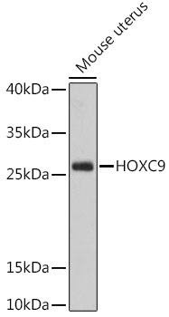 Anti-HOXC9 Antibody (CAB12630)