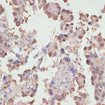 Anti-YAP1 Antibody (CAB11265)