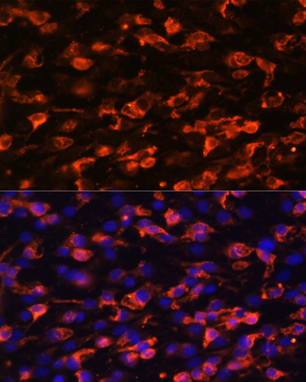 Anti-PIK3C2A Polyclonal Antibody (CAB8526)