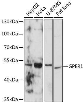 Anti-GPER1 Antibody (CAB10217)