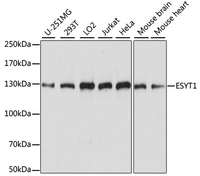 Anti-ESYT1 Antibody (CAB15410)