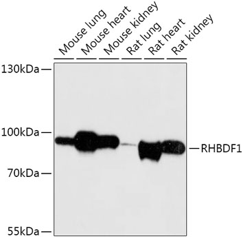 Anti-RHBDF1 Antibody (CAB17754)