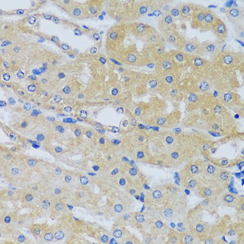 Anti-CABP7 Antibody (CAB13703)