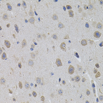 Anti-SUMO3 Antibody (CAB3099)