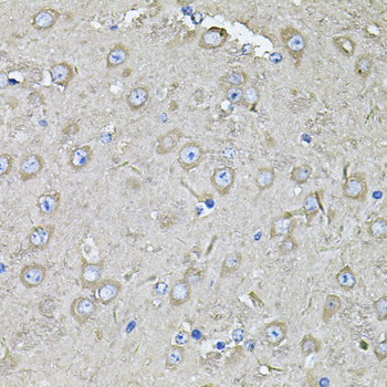 Anti-EIF3C Antibody (CAB7022)