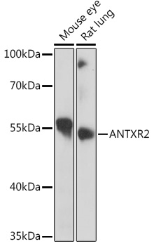 Anti-ANTXR2 Antibody (CAB6526)