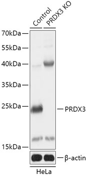 Anti-PRDX3 Antibody [KO Validated] (CAB18022)