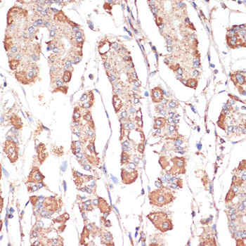 Anti-ATP5A1 Antibody (CAB5884)