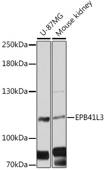 Anti-EPB41L3 Antibody (CAB12759)