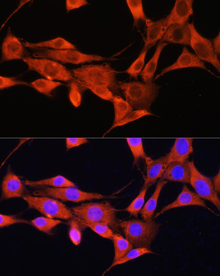 Anti-AMT Polyclonal Antibody (CAB9926)