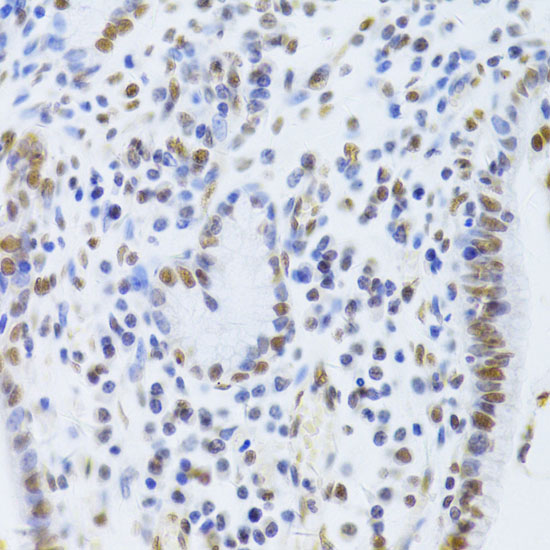 Anti-XRCC5 Antibody (CAB5862)