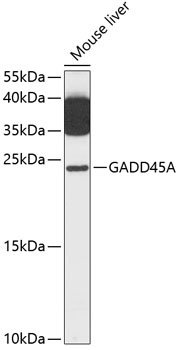 Anti-GADD45A Antibody (CAB13486)