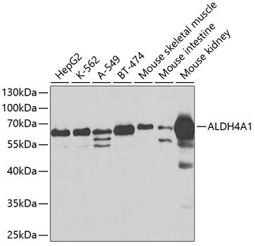 Anti-ALDH4A1 Antibody (CAB2595)