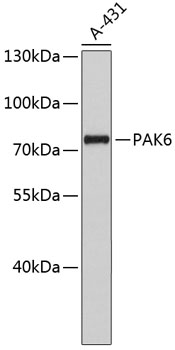 Anti-PAK6 Antibody (CAB4871)