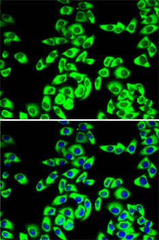 Anti-RPL14 Antibody (CAB6724)