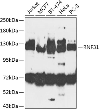 Anti-RNF31 Polyclonal Antibody (CAB8227)