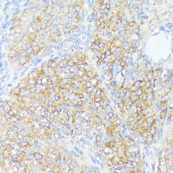 Anti-SLC7A2 Antibody (CAB14574)