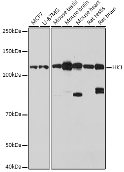 Anti-HK1 Antibody [KO Validated] (CAB1054)