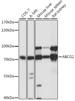 Anti-ABCG2 Antibody (CAB5661)