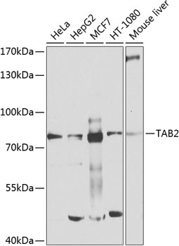 Anti-TAB2 Polyclonal Antibody (CAB9867)