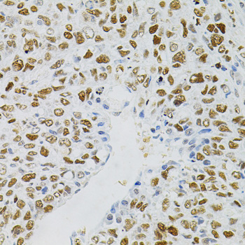 Anti-MCM2 Antibody (CAB0502)