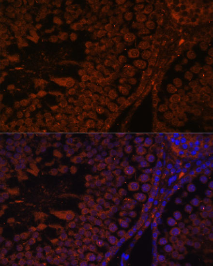 Anti-TPD52L3 Antibody (CAB15545)