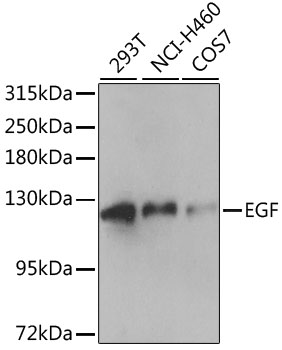 Anti-EGF Antibody (CAB13615)