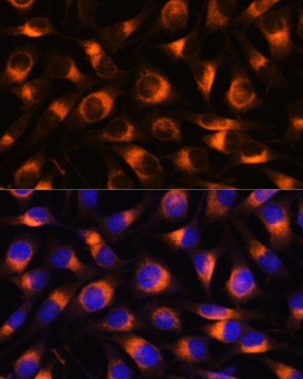 Anti-VAT1 Antibody [KO Validated] (CAB17077)