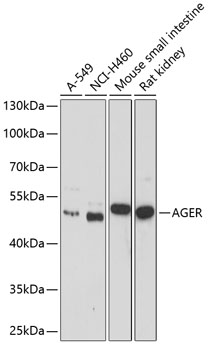 Anti-AGER Antibody (CAB1395)