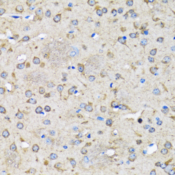 Anti-LC3B Antibody (CAB11280)