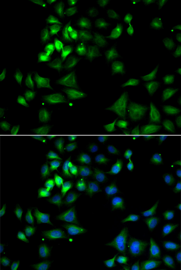 Anti-HYOU1 Antibody (CAB12313)