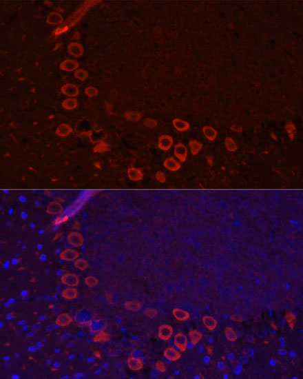 Anti-SLC1A1 Antibody (CAB2903)