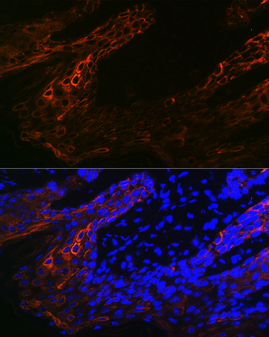 Anti-KRT14 Antibody (CAB15069)