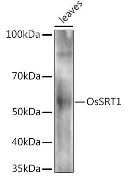 Western blot analysis of extracts of various tissues from the japonica rice (Oryza sativa L. ) variety Zhonghua 11, using OsSRT1 antibody at 1:1000 dilution. Secondary antibody: HRP Goat Anti-Rabbit IgG (H+L) at 1:10000 dilution. Lysates/proteins: 25ug per lane. Blocking buffer: 3% nonfat dry milk in TBST. Detection: ECL Enhanced Kit. Exposure time: 30s.