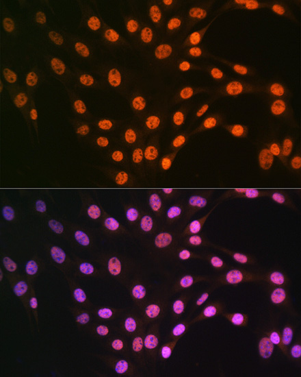 Anti-TARDBP Antibody (CAB13405)